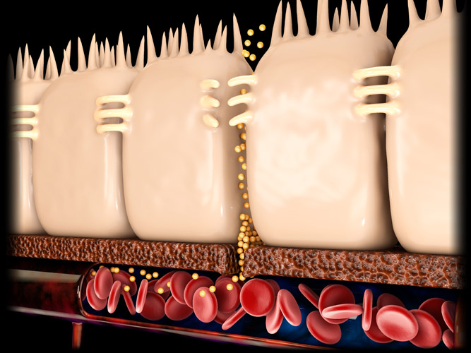 Leaky Gut
