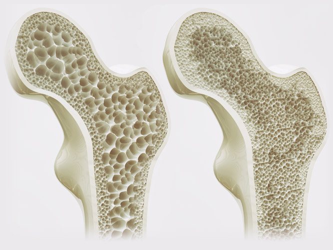 Increase bone density of D-(+)-Cellobiose Increase bone density of D-(+)-Cellobiose