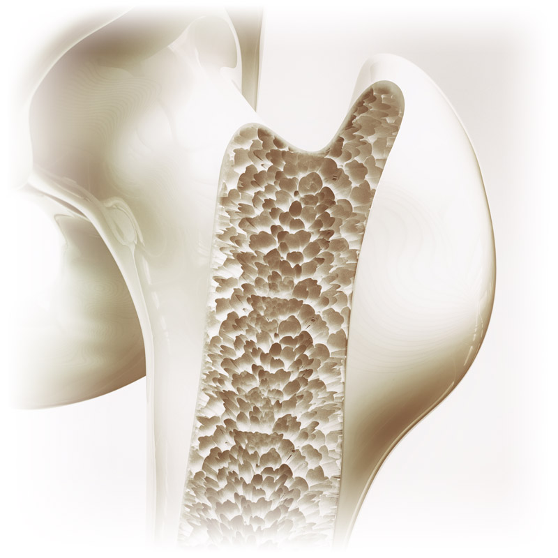 15 Question Osteoporosis Quiz Nutreance
