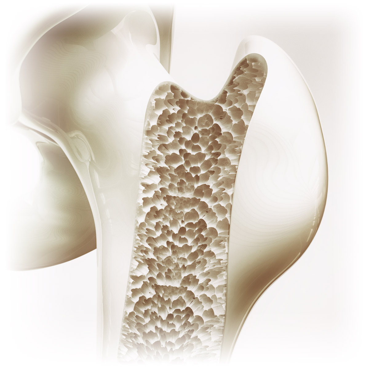 15 Question Osteoporosis Quiz Nutreance