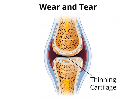 Wear and Tear